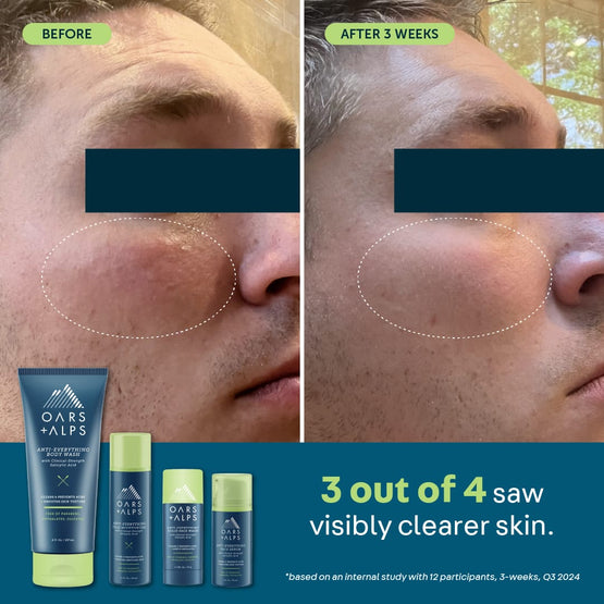 Anti-Everything Solid Face Wash